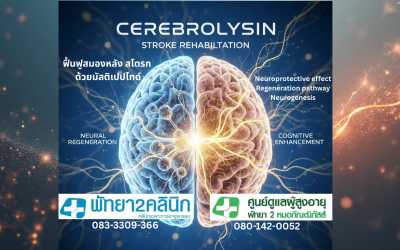 การฟื้นฟูหลัง Stroke ด้วย Cerebrolysin และ การทำกายภาพบำบัดเข้มข้น