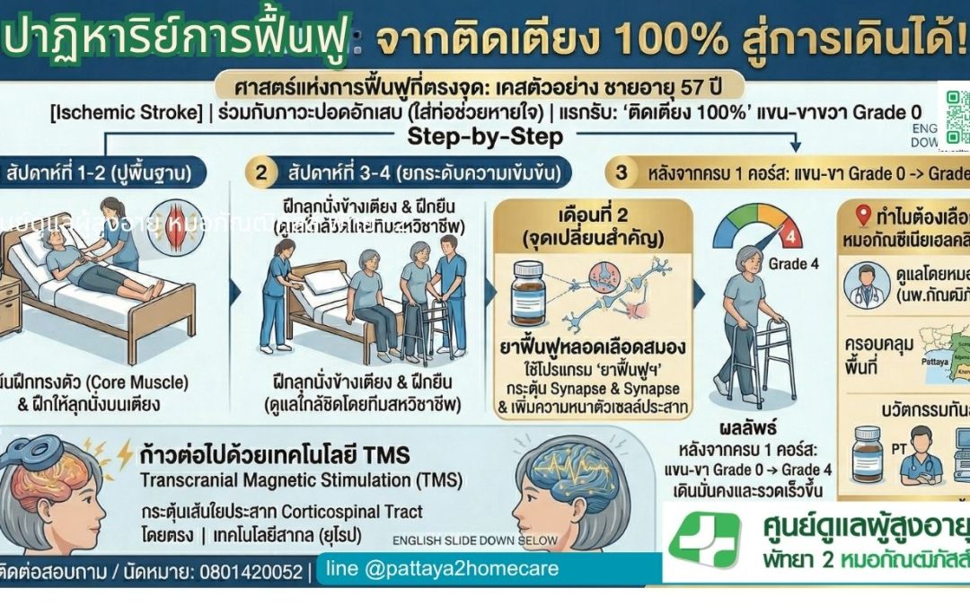 ติดเตียง” สู่ “ก้าวเดิน”: ปาฏิหาริย์แห่งการฟื้นฟูผู้ป่วยหลอดเลือดสมอง (Stroke) ที่หมอกัณซีเนียเฮลท์ ( #กายภาพบำบัด และ #ยาดริปยาบำรุงสมองCereBrlysin)