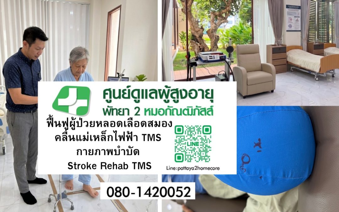 แพ็กเกจฟื้นฟูผู้ป่วยหลอดเลือดสมอง (Stroke) พัทยา ด้วยคลื่นแม่เหล็กไฟฟ้า (TMS) และกายภาพบำบัด